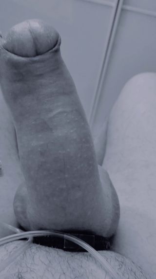 RATCVAC